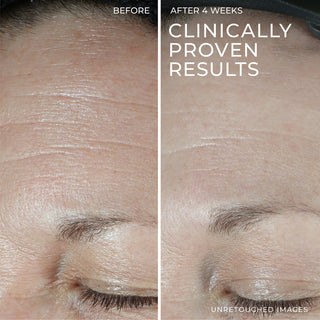 Hydration+ Moisturizer is clinically proven to deliver results. There are unretouched before and after images shown. The before image shows deep forehead wrinkles. The after 4 week image shows drastically reduced foreheads lines.