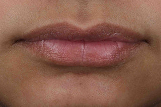 Customer lips 4 weeks after using the Derm Correxion Lip Volumizer