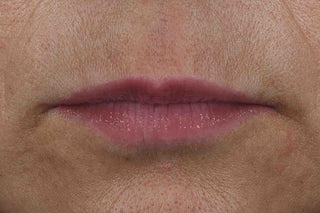 Customer lips 3 minutes after using the Derm Correxion Lip Volumizer