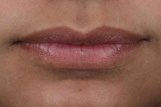 Customer lips before using the Derm Correxion Lip Volumizer