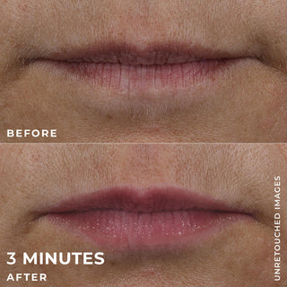 Before and after 3 minutes of clients lips