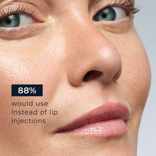 Close up of model's face with caption "88% would use instead of lip injections"