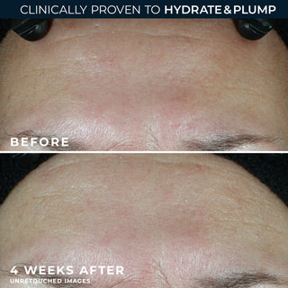 Before and after 4 weeks
Clinically proven to hydrate & Plump