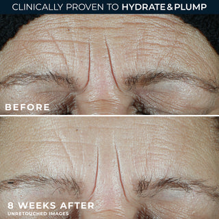 Before and after 8 weeks
Clinically proven to hydrate & Plump