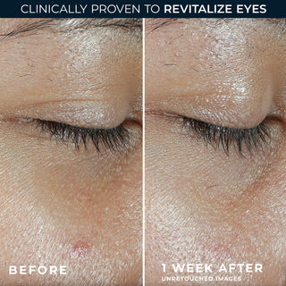 clinically proven to revitalize eyes