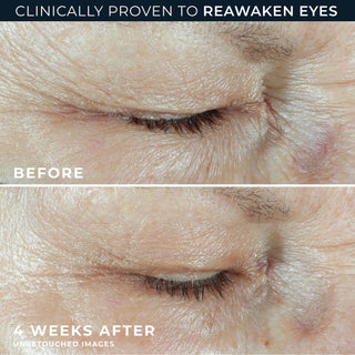 before and after 4 weeks
clinically proven to reawaken eyes