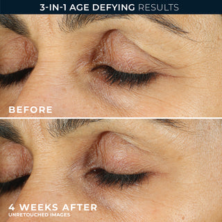 BEfore and after photos
3-in-1 age defying results
before
4 weeks after unretouched images