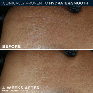 Before & after photos
clinically proven to hydrate & smooth
before
4 weeks after unretouched images