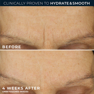 Before & after photos
clinically proven to hydrate & smooth
before
4 weeks after unretouched images